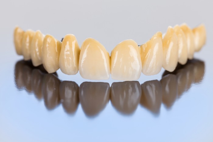 A Comprehensive Guide to Choosing the Right Dental Zirconia