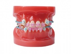 HG-B1-03 Ortho Ceramic Bracket Model