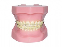 HG-B3-03 Orth Ceramic Bracket Model