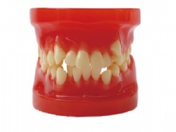 HG-B4 Orthodontic Model