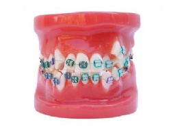 HG-B4-02 Ortho Metal & Ceramic Bracket Model