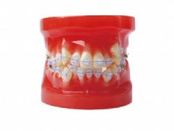 HG-B4-03 Ortho Ceramic Bracket Model