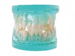 HG-B5 Orthodontic Model