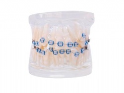 HG-B5-03 Ortho Ceramic Bracket