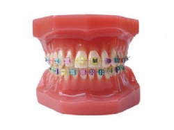 HG-B6-02 Ortho Metal & Ceramic Bracket Model