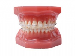 HG-B6-03 Ortho Ceramic Bracket Model