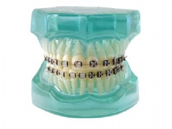 HG-B7-02 Ortho Metal & Ceramic Bracket Model