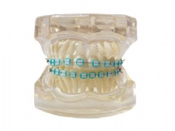 HG-B7-03 Ortho Ceramic Bracket Model