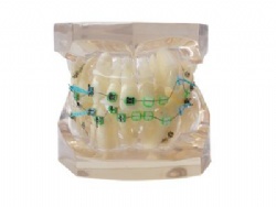 HG-B8-02 Ortho Metal & Ceramic Bracket Model