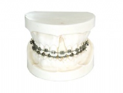 HG-B10 Ortho With Edgewise Bracket Model