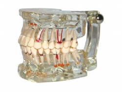 HG-C1 Pathology Model with Half Implant