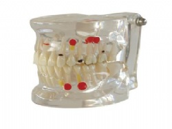HG-C3 Pathology Model with Half can be removable