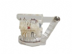 HG-C15-01 Implant pathological model