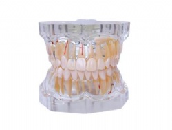 HG-C16-01 2.5Times Pathology Model(two color)