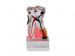 HG-C17-01 4Times periodontal disease
