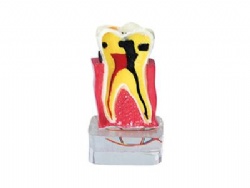 HG-C18 4times periodontal with Nerve