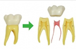 HG-C19 6Times Anatomy Teeth Model