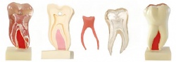 HG-C21 Anatomic Profile Model of Mandibular Molar