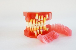HG-E2 5-9 year old dental development model