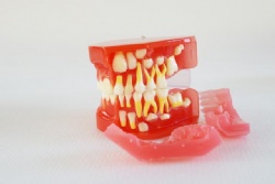 HG-E3 9-12 year old dental development model