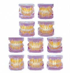 HG-E7 Orthodontic Classification