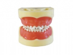HG-E10 Caries model of Child