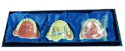 HG-G13 Prosthodontic Model