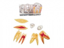HG-M4-02 4 Times decomposition model