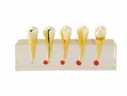 HG-M5 Dental pulp model