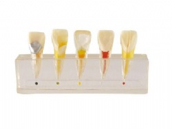 HG-M6 Dental pulp model