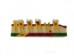 HG-M7 Caries Developing Model
