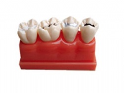 HG-M10 Pit and fissure closure model