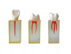 HG-N5 Root canal model