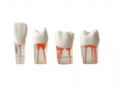 HG-N6 Root canal model