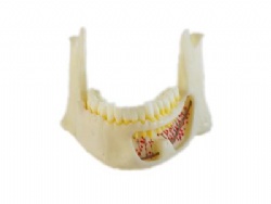 HG-P2 Anatomic Mandible Model