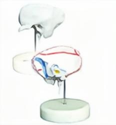 HG-P5 Temporal Bone Model