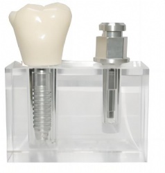 HG-T20 Trans Implant Model